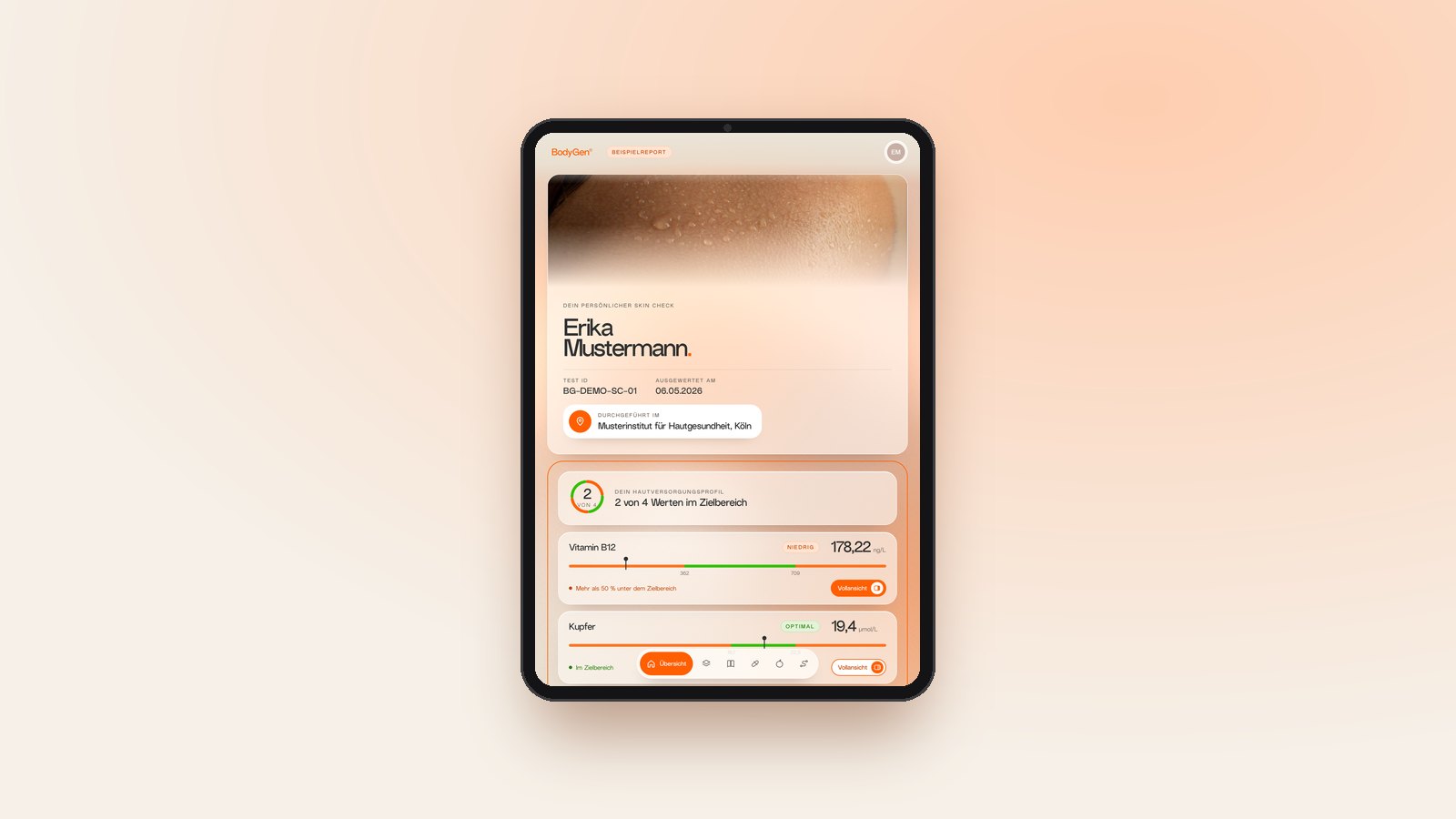 Persönlicher Skin Check Report auf dem iPad